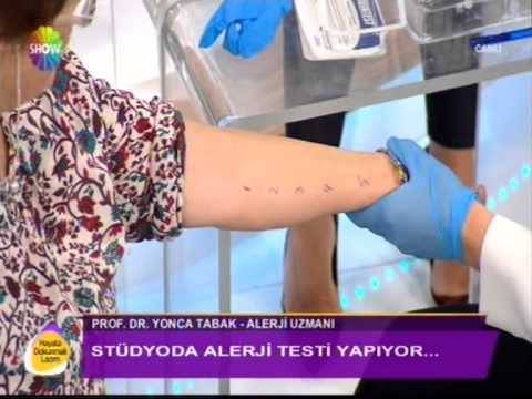 alerji,yonca tabak,istanbul alerji doktoru