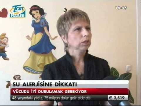 su alerjisi,yonca tabak